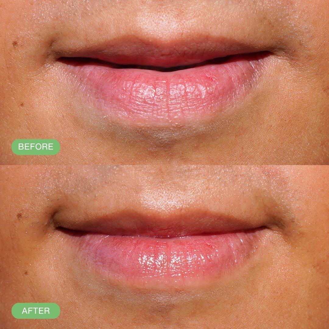 Hydrating Lip Balm Set