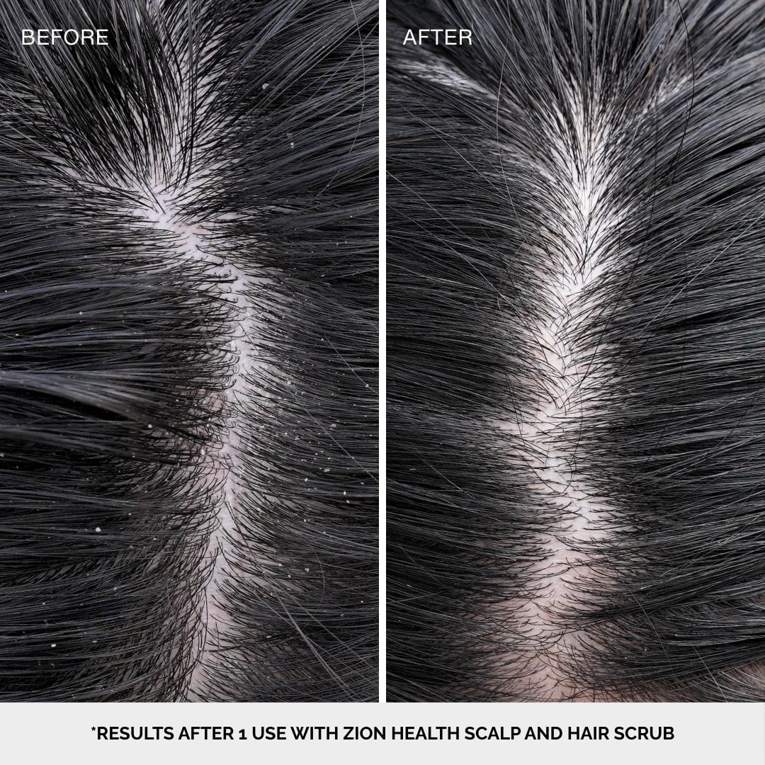 Scalp & Hair Scrub Pear Blossom